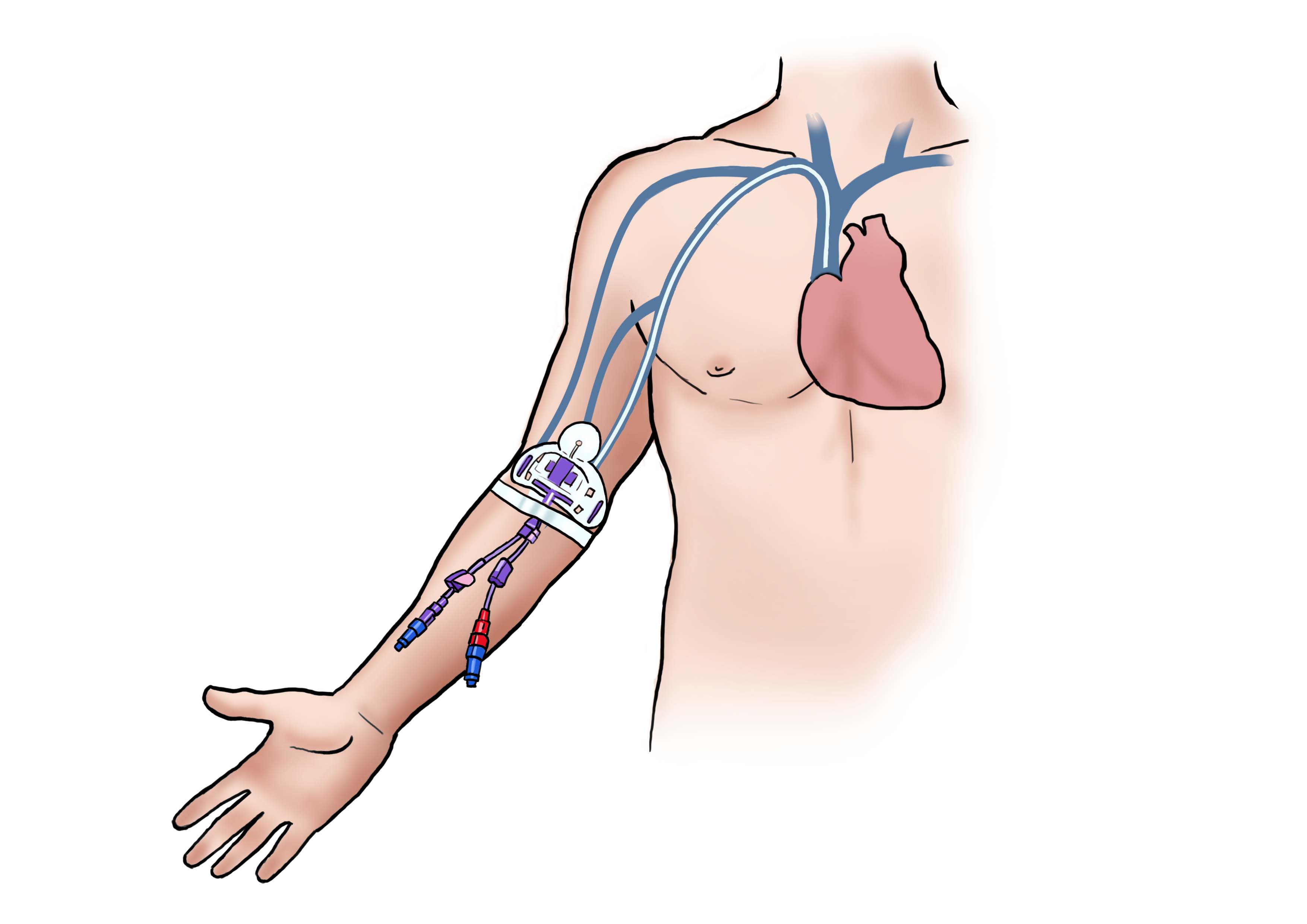 Que es una parada cardiorrespiratoria